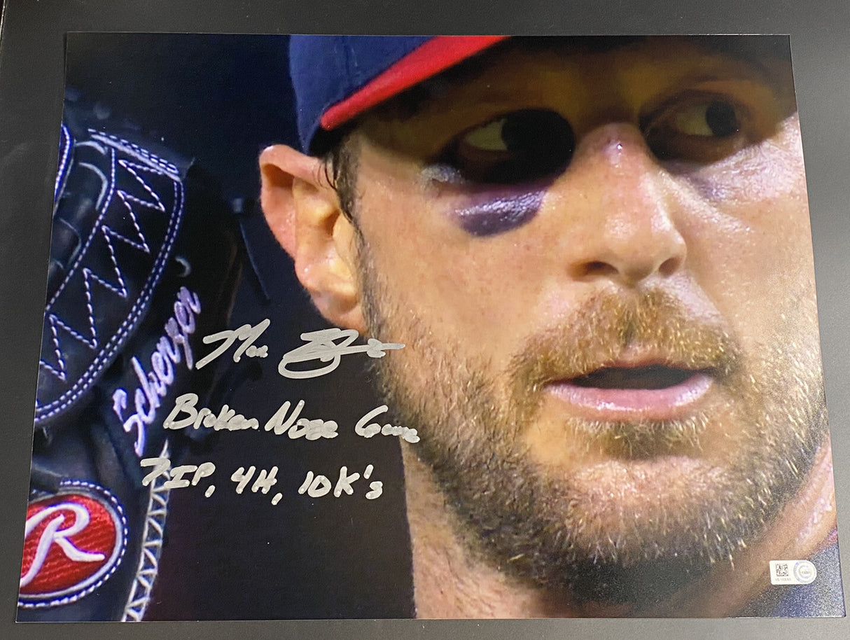 Max Scherzer Broken Nose Game 7IP, 4H, 10 Ks Signed 11x14 Photo MLB Holo